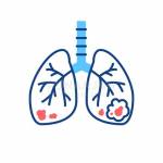 Lung Cancer Treatment Profile Picture