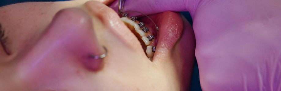 Dental and Braces Cover Image