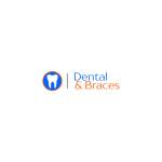 Dental and Braces