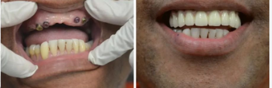dentalaesthetics Cover Image