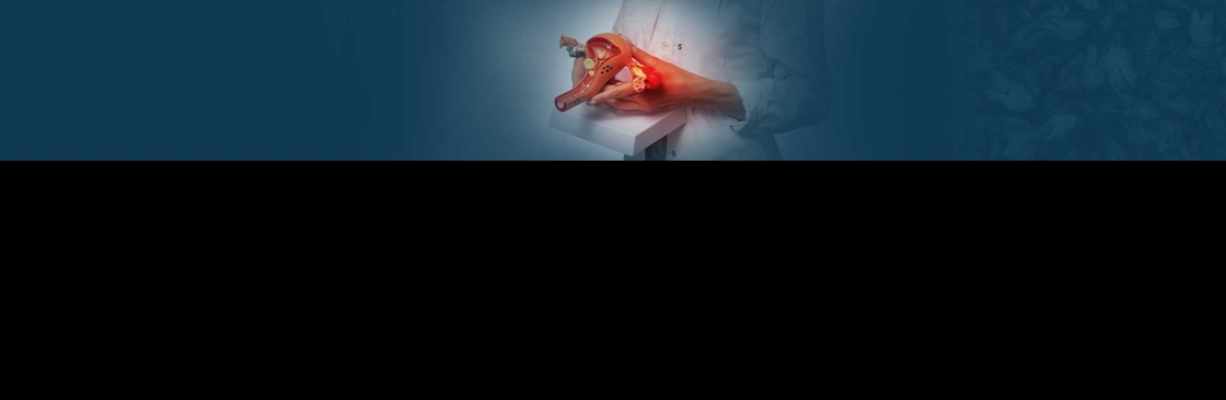 Best Ovarian Cancer Treatment Hospitals in Hyderabad Cover Image