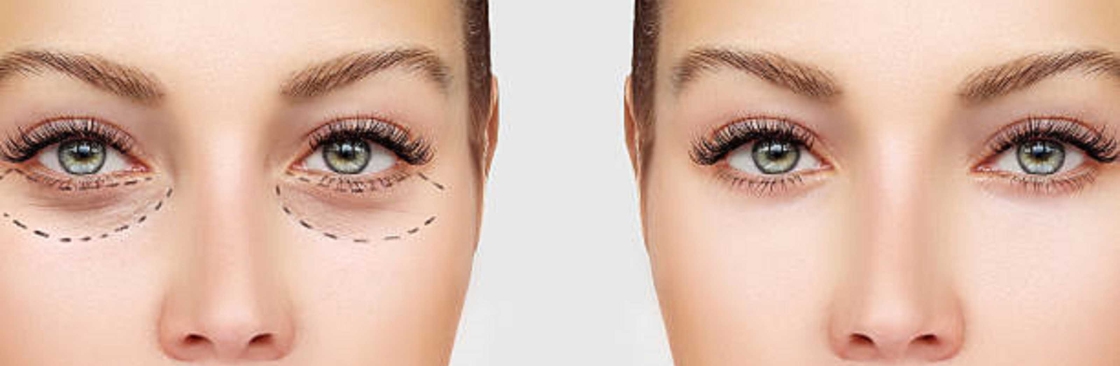 EyeLid Surgery in Riyadh Cover Image