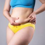 Liposuction in Riyadh