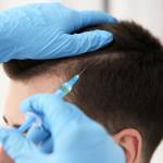PRP Hair Treatment in Riyadh