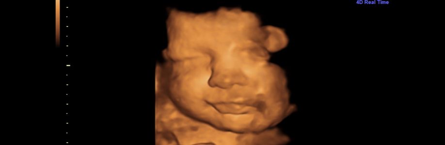 Baby Moments Cover Image