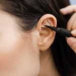 Ear Reshaping Surgery in Riyadh