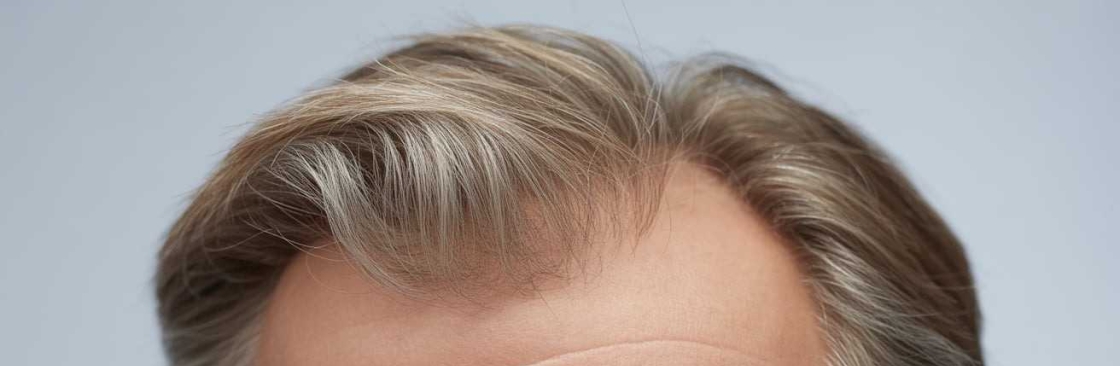 Dr.Anirudh's Advanced Hair Transplant and Dental Clinic Skin Specialist Doctor in Hydera Cover Image