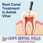 Root Canal