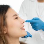 Rhinoplasty in Riyadh