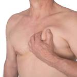 Gynecomastia Surgery in Riyadh