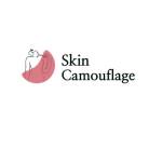 Skin Camouflage