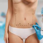 Tummy Tuck surgery in Riyadh
