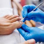 Ingrown toenail surgery in Riyadh