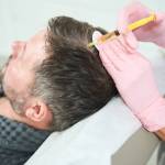 PRP Hair Treatment in Riyadh