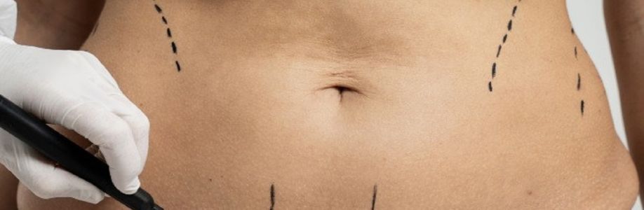 Surface 360 Cosmetic Surgery and Med Spa Cover Image